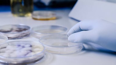 人抗增殖細(xì)胞核抗原抗體(PCNA)ELISA Kit試劑盒/測(cè)試盒 人抗增殖細(xì)胞核抗原抗體(PCNA)ELISA Kit試劑盒/測(cè)試盒