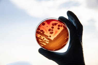 谷氨酸含量檢測試劑盒圖1 谷氨酸含量檢測試劑盒圖1