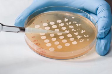 生物素親和素ELISA試劑盒系統介紹 生物素親和素ELISA試劑盒系統介紹